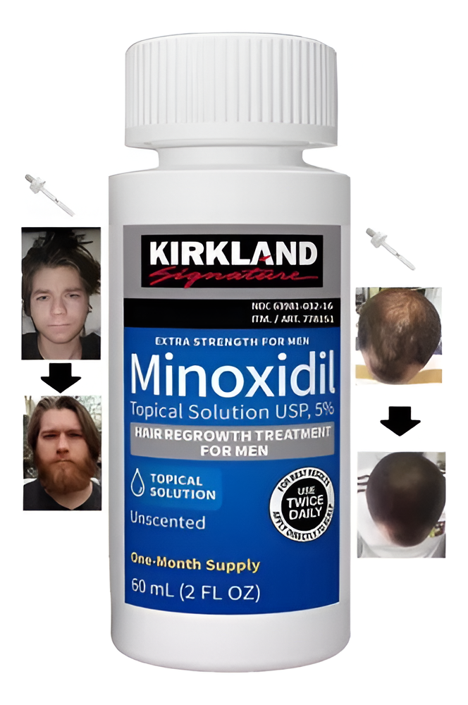 Minoxidil Kirkland 5% — 1 Frasco 60ml con Aplicador
